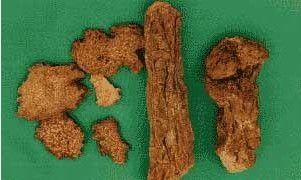 �������Y